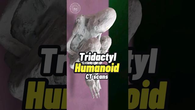 CT-scans of Tridactyl Humanoid Body - ALIEN ? #shorts #status  ????