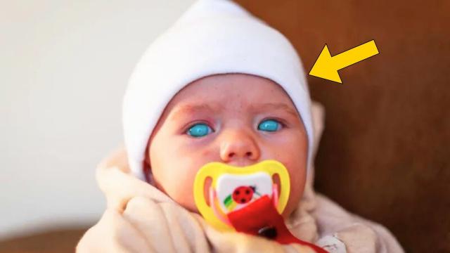 Baby's Eyes Suddenly Turn Completely Blue - When Parents Realise Why They Call The Doctor