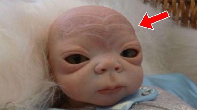 Woman Gave Birth To Strange-Looking Baby - Doctor Is Shocked When Doing DNA Test