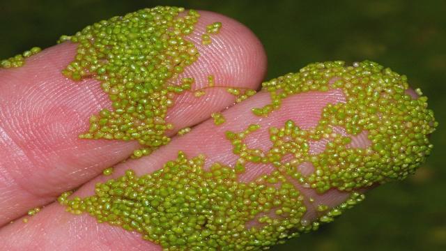 Man Wakes Up With Little Bubbles On Finger - Doctors Shocked Discovering What It Is