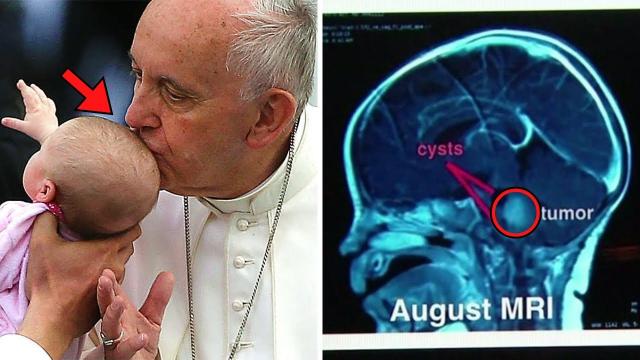 Pope Kissed Baby on Her Head  6 Weeks Later, Parents Discovered Something Very Frightening