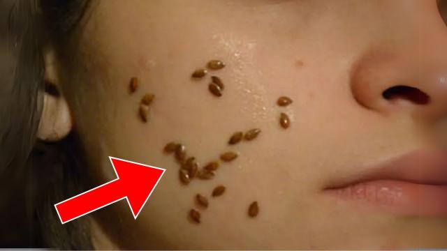 Woman Wakes Up With Strange Spots On Cheek - When Doctor Sees It, He Calls The Police