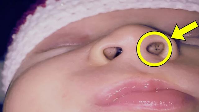 Mom Discovers Strange Holes in Baby’s Nose - When The Doctors See It, They Call The Police