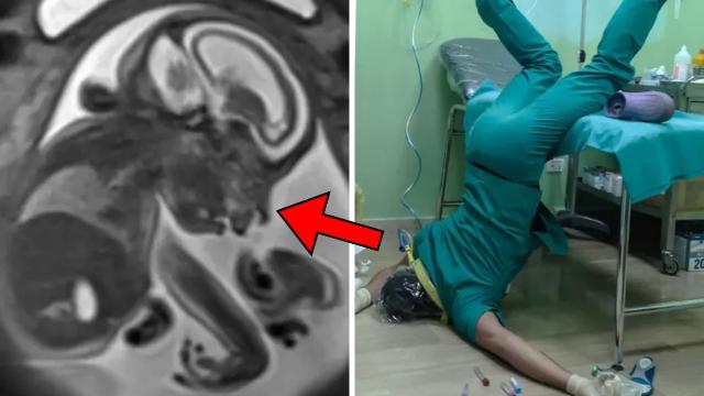 Woman Goes To Doctor - The Doctor Faints When He Sees This On Ultrasound