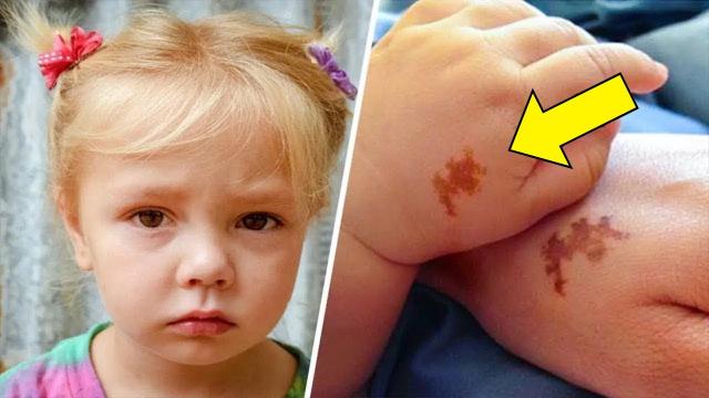 Mom Adopts Girl With Matching Birthmark; Screams Upon Seeing DNA Results